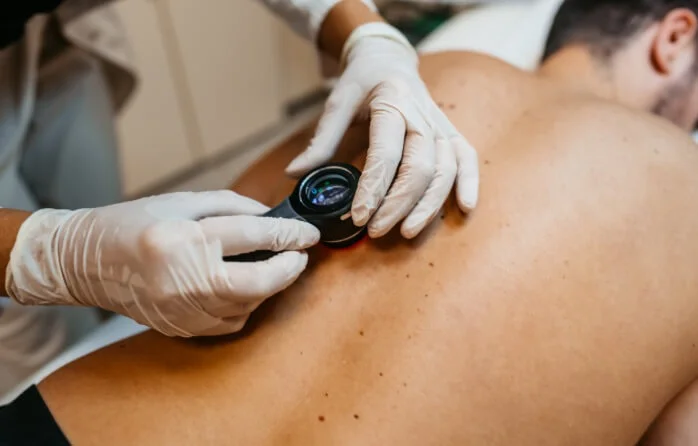 dermatologist giving skin check
