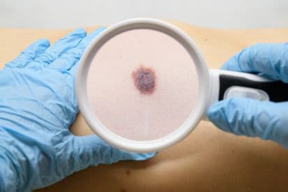 pinnacleskin.com /treatments/skin-cancer-screenings-and-total-body-skin-exams Carousel 1 Image 6